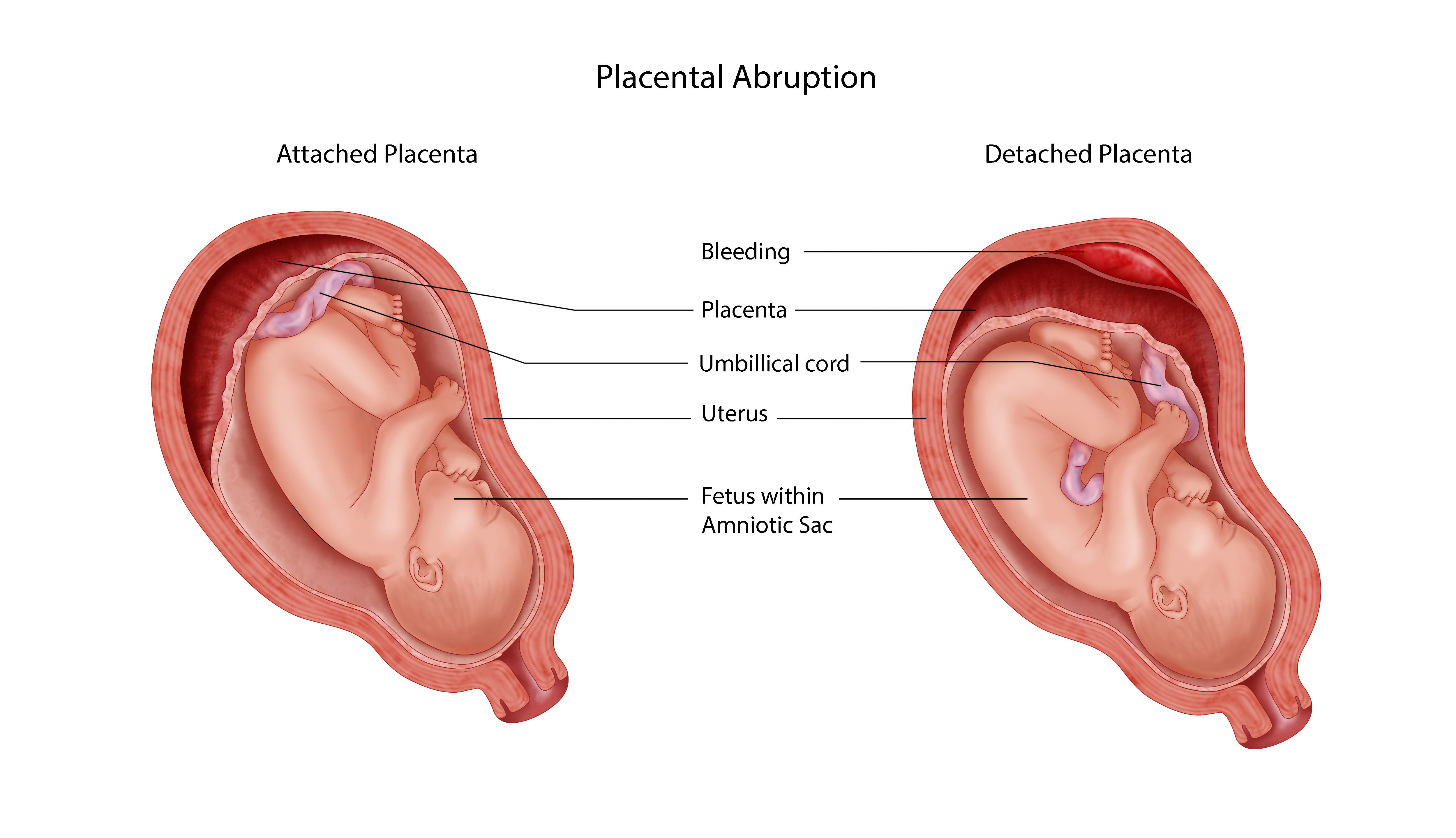 Плацента на какой неделе. Placenta specrrs характеризуется.